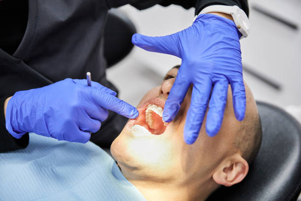 Best Tooth Infection Emergency Dentist  in Bellflower, CA